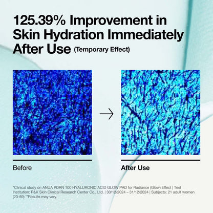 Anua - PDRN 100 Hyaluronic Acid Glow pad